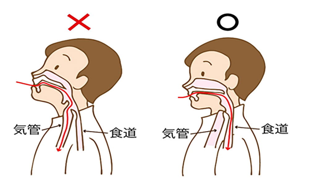 あご引き嚥下（安全な飲み込みの練習）