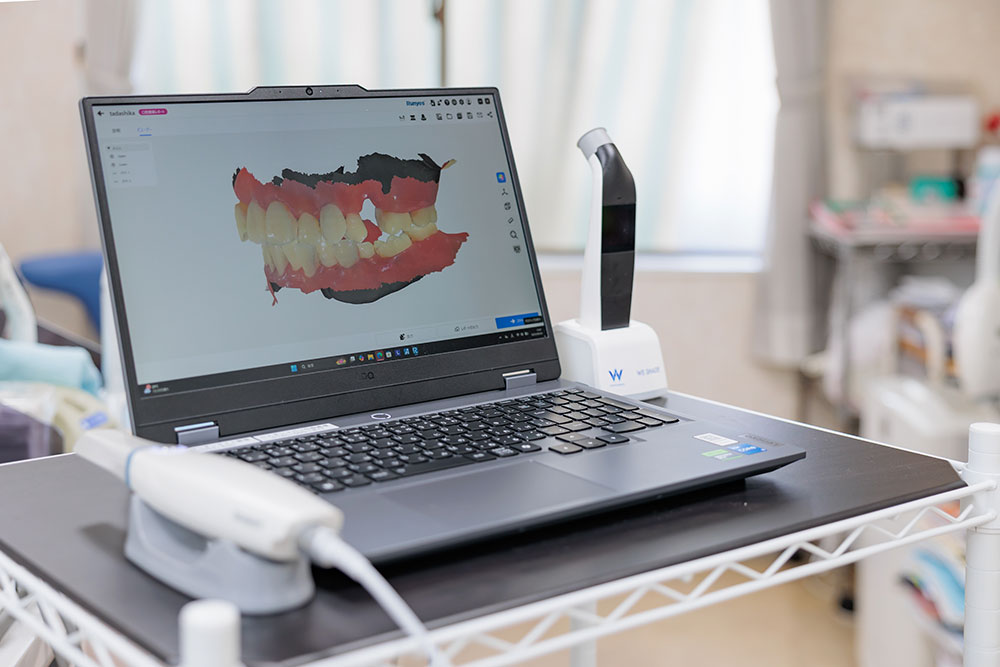 口腔内スキャナー