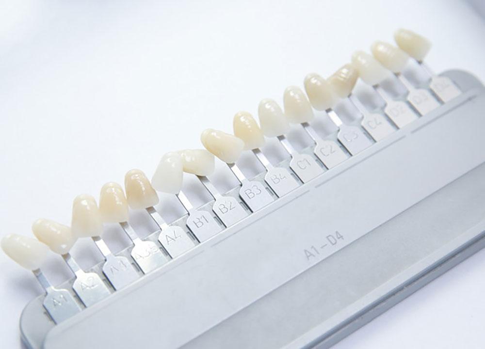 ライフスタイルに合わせたホワイトニング